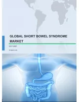 Global Short Bowel Syndrome (SBS) Market 2017-2021